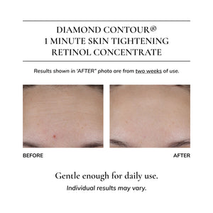 Diamond Contour Daily Essentials Gift Set