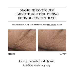 Diamond Contour 1 Minute Skin Tightening Retinol Concentrate