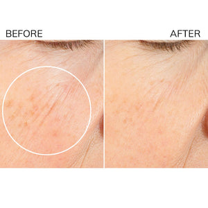 Diamond Contour 20% Vitamin C Skin Resurfacing Oxygen Peel