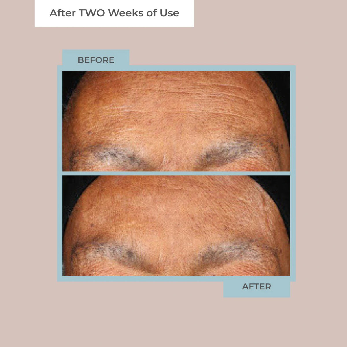 Diamond Contour Collagen Rejuvenation 14-Day Transformation Kit