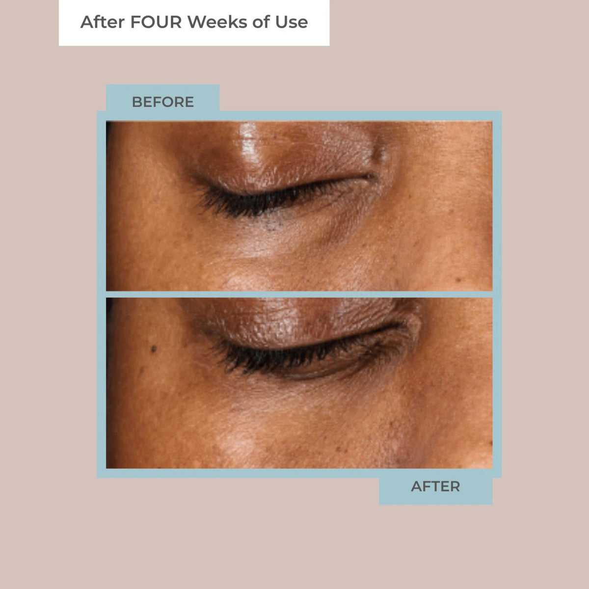 Diamond Contour Collagen Rejuvenation 14-Day Transformation Kit