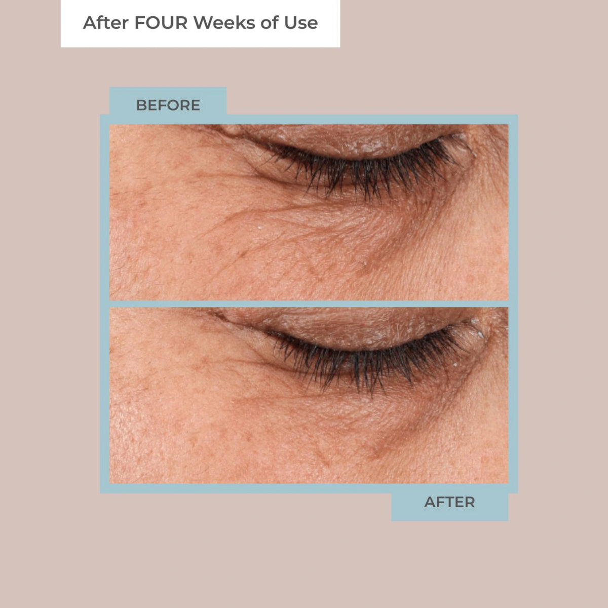 Diamond Contour Collagen Rejuvenation 14-Day Transformation Kit