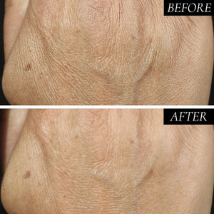 Diamond Contour Intensive Anti-Aging Hand Treatment