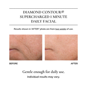 Diamond Contour 5-piece Discovery Kit