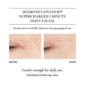 Diamond Contour 5-piece Discovery Kit