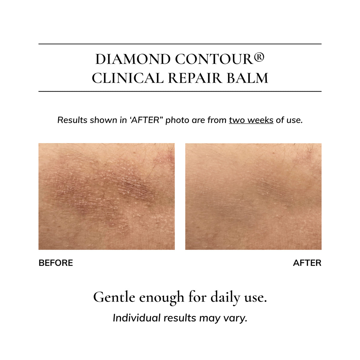 Diamond Contour Clinical Repair Balm: Eczema & Dermatitis