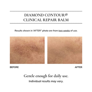 Diamond Contour Clinical Repair Balm