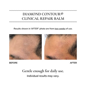 Diamond Contour Clinical Repair Balm