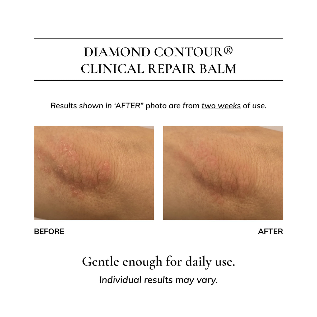 Diamond Contour Clinical Repair Balm: Eczema & Dermatitis