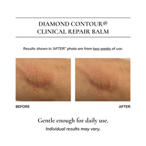 Diamond Contour Clinical Repair Balm