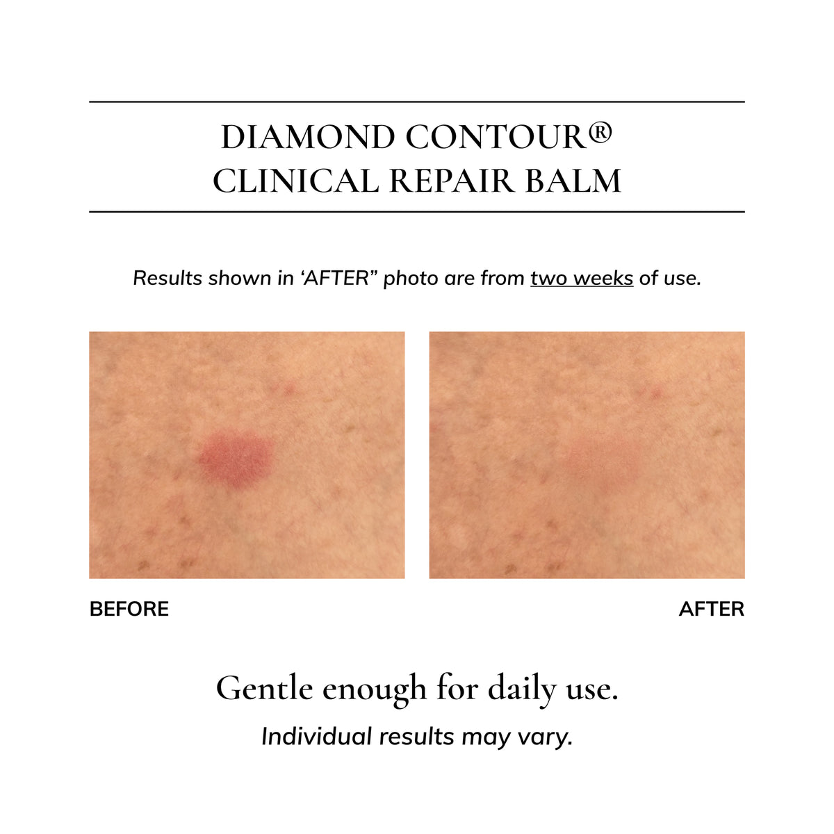 Diamond Contour Clinical Repair Balm: Eczema & Dermatitis