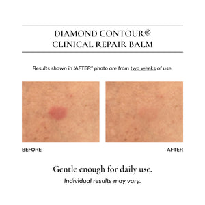 Diamond Contour Clinical Repair Balm