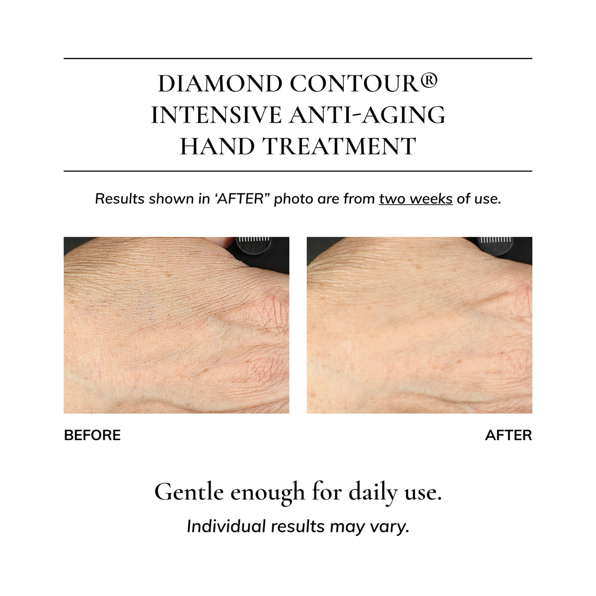 Diamond Contour Intensive Anti-Aging Hand Treatment