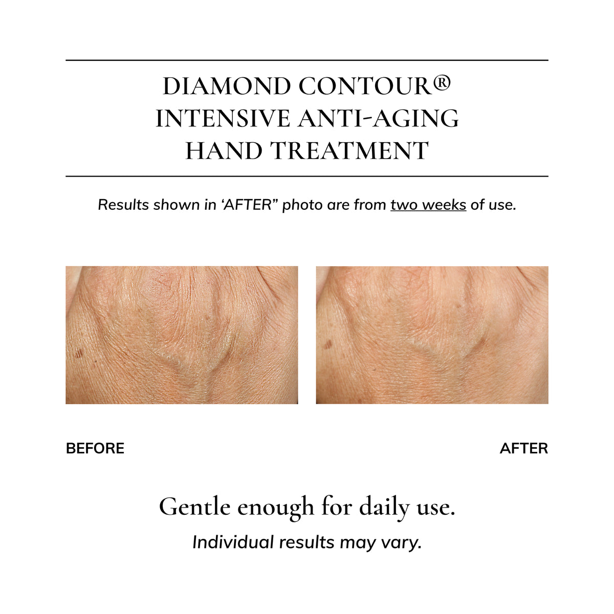 Diamond Contour Intensive Anti-Aging Hand Treatment