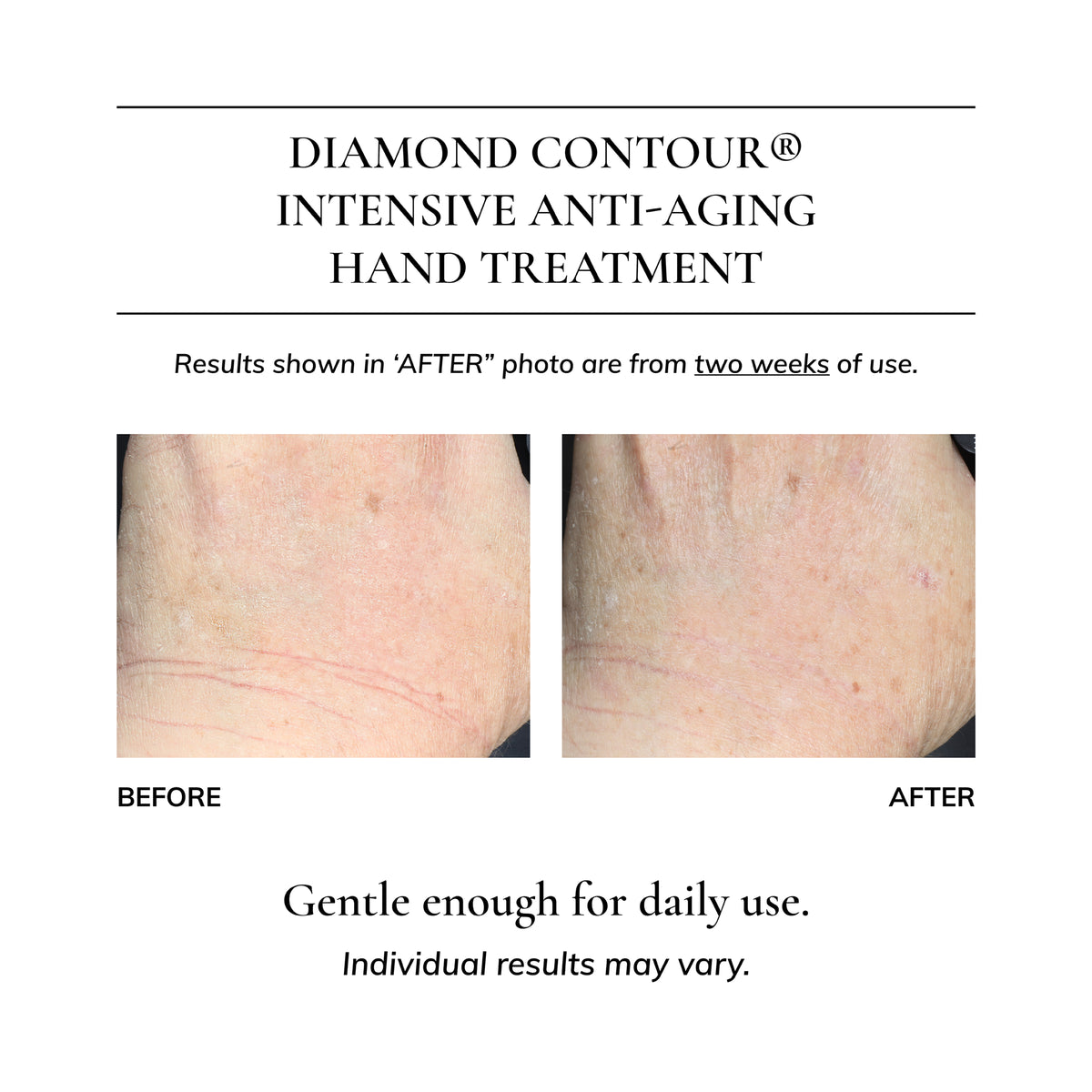 Diamond Contour Intensive Anti-Aging Hand Treatment