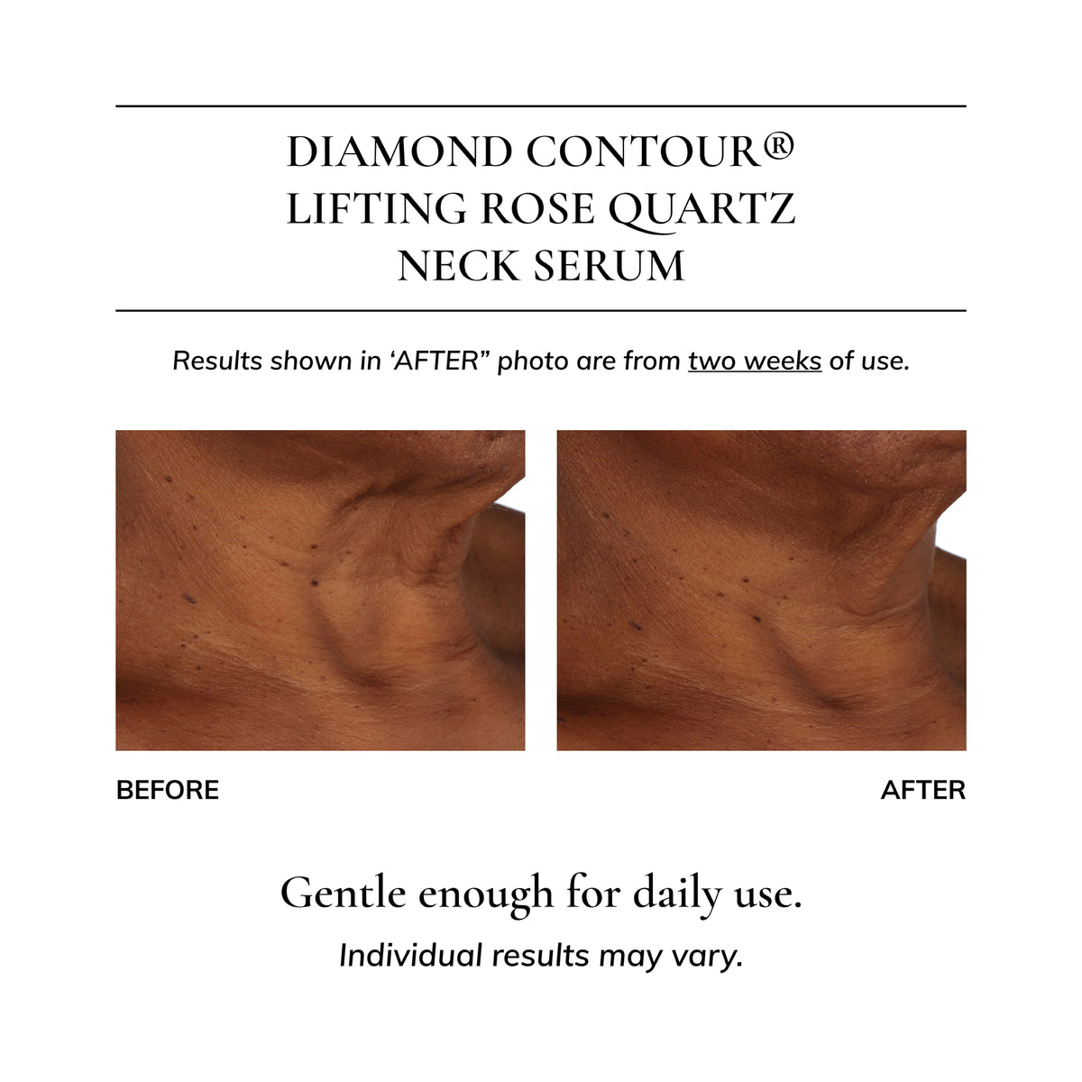 Diamond Contour 5-piece Discovery Kit