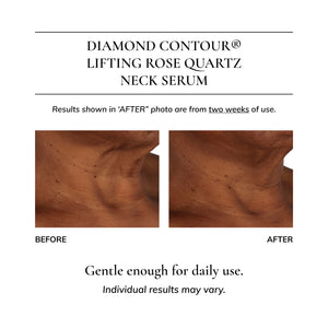 Diamond Contour 5-piece Discovery Kit