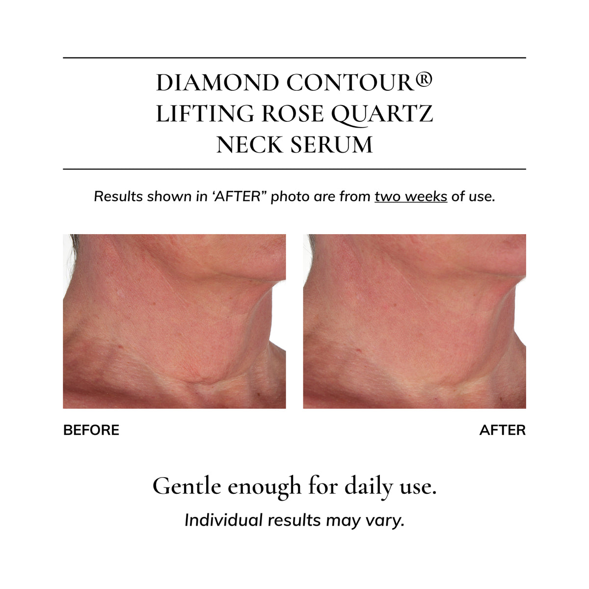 Diamond Contour Lifting Rose Quartz Neck Serum