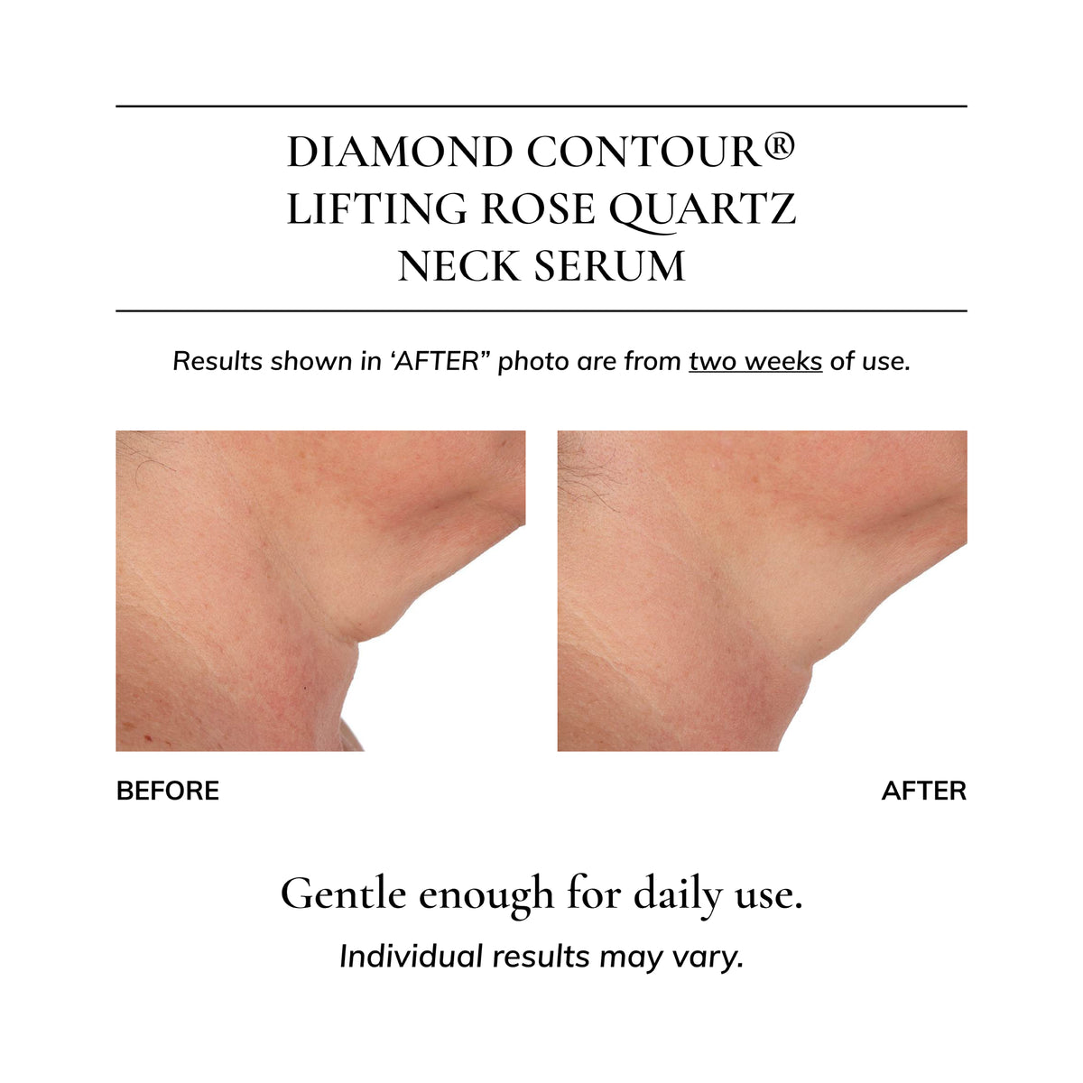 Diamond Contour Lifting Rose Quartz Neck Serum