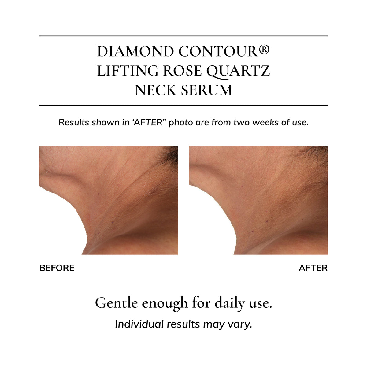 Diamond Contour 5-piece Discovery Kit