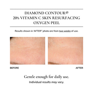 Diamond Contour 20% Vitamin C Skin Resurfacing Oxygen Peel