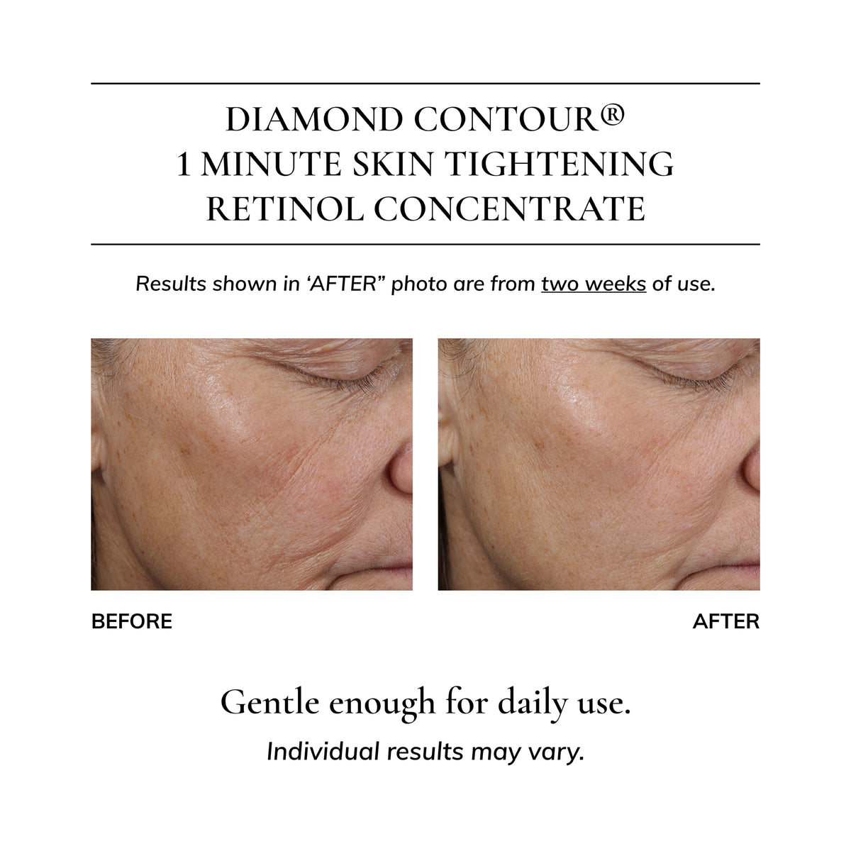 Diamond Contour 1 Minute Skin Tightening Retinol Concentrate