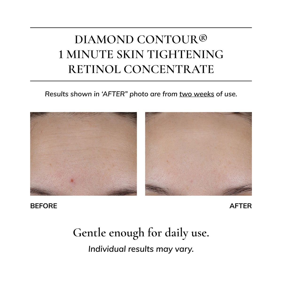 Diamond Contour 1 Minute Skin Tightening Retinol Concentrate