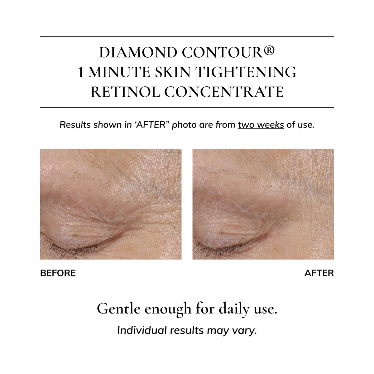 Diamond Contour 1 Minute Skin Tightening Retinol Concentrate