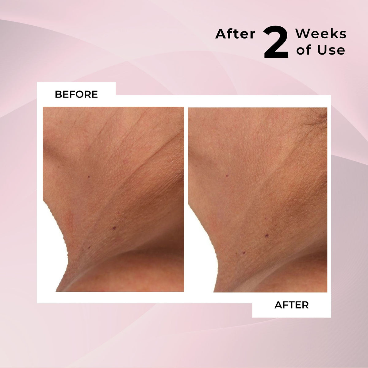 Diamond Contour Neck Serum Duo