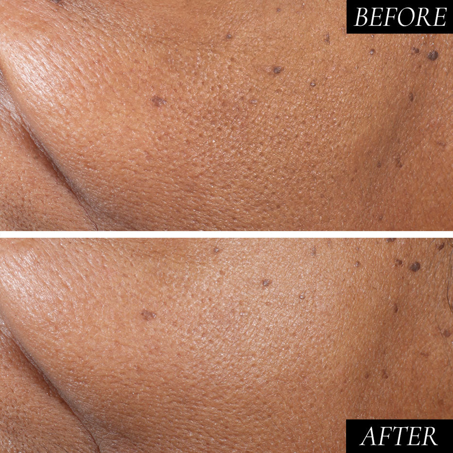 Diamond Contour Supercharged 1 Minute Daily Facial
