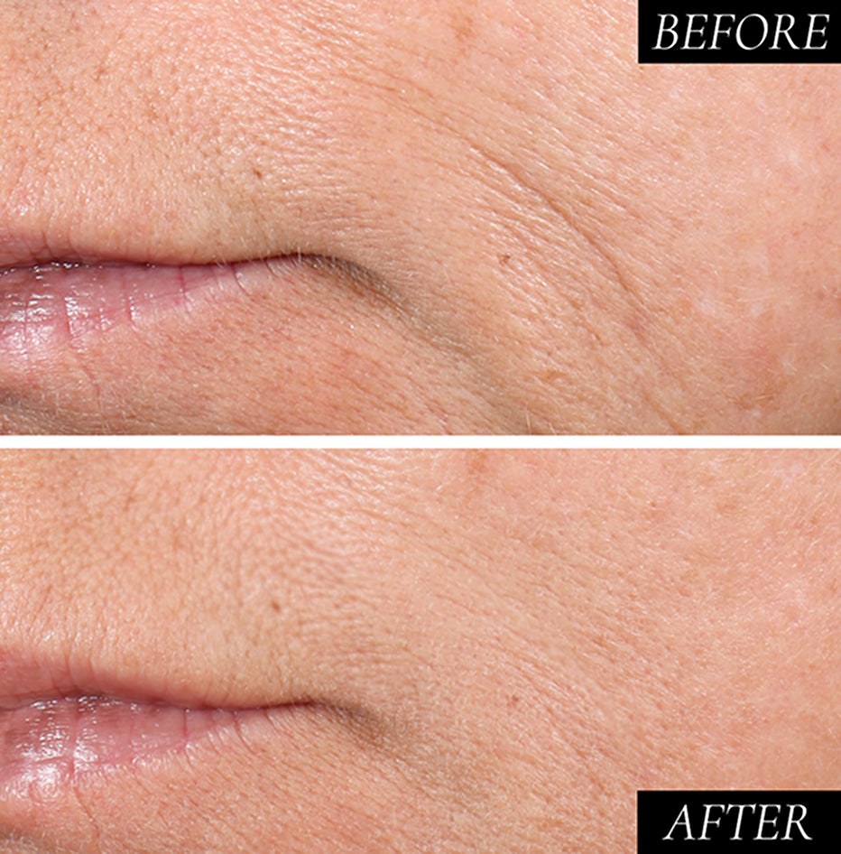Diamond Contour Supercharged 1 Minute Daily Facial